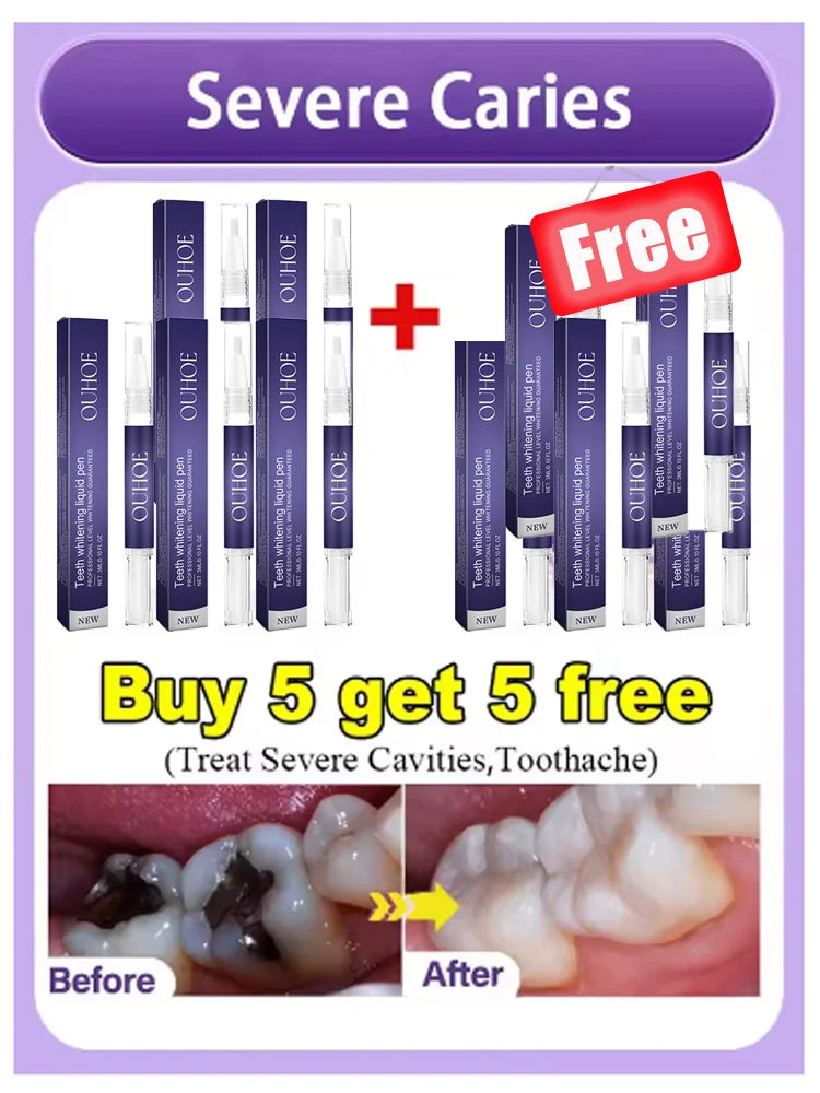 Ouhoe V34 Professional Teeth Whitening And Repair Gel Breaks Down The Stains On The Tooth Surface To Achieve Highly Efficient