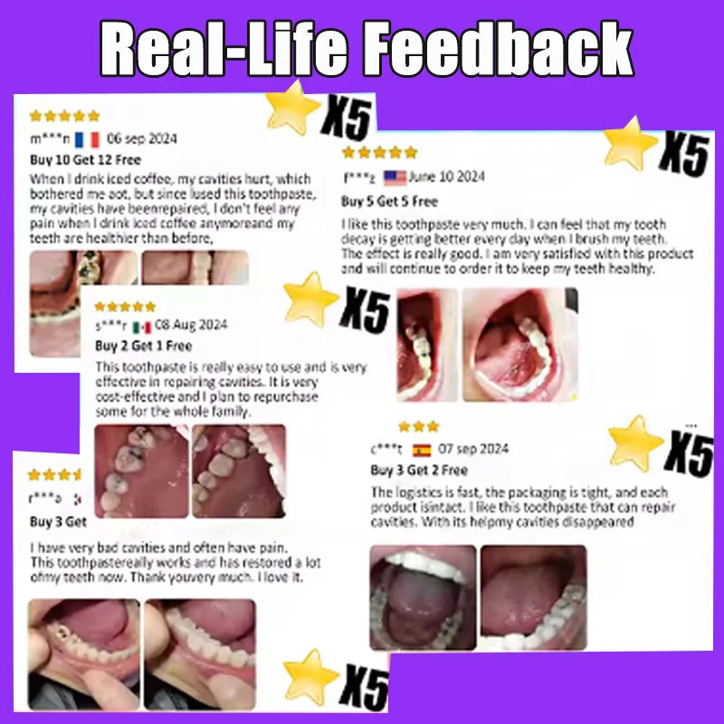 Ouhoe V34 Professional Teeth Whitening And Repair Gel Breaks Down The Stains On The Tooth Surface To Achieve Highly Efficient