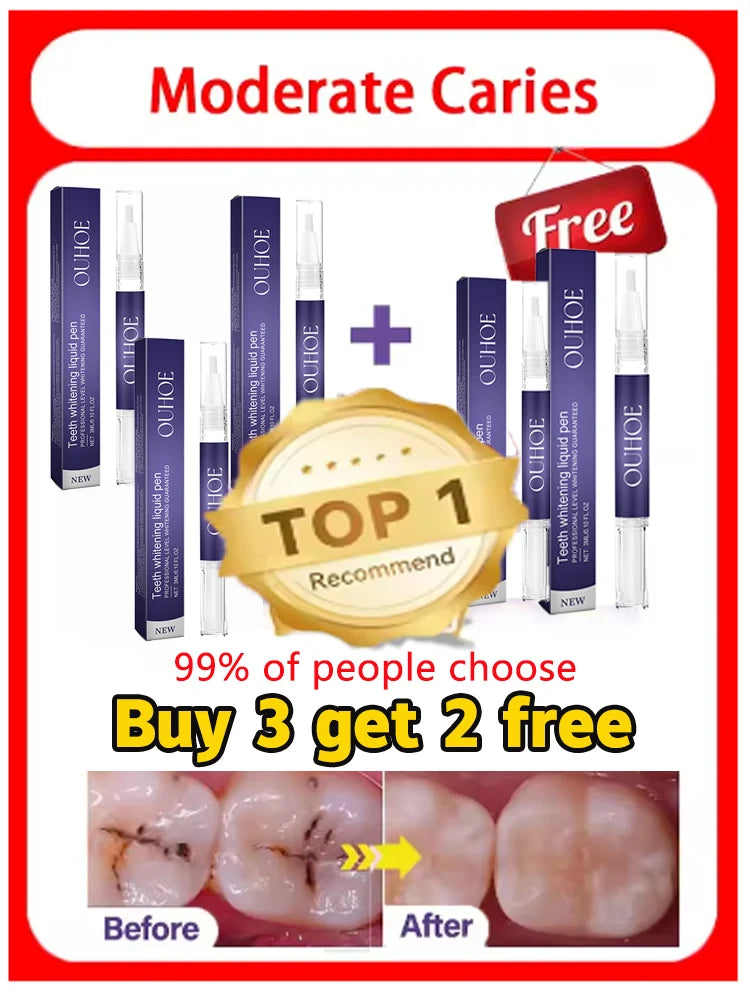 Ouhoe V34 Professional Teeth Whitening And Repair Gel Breaks Down The Stains On The Tooth Surface To Achieve Highly Efficient