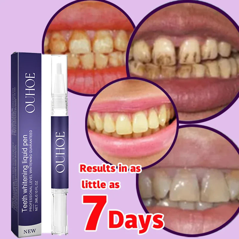 Ouhoe V34 Professional Teeth Whitening And Repair Gel Breaks Down The Stains On The Tooth Surface To Achieve Highly Efficient